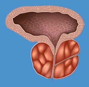 I tipici sintomi della prostatite