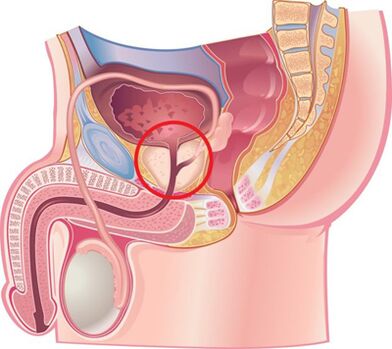 Posizione della prostata negli uomini