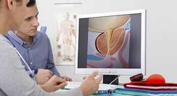 Diagnosi di prostatite in un uomo